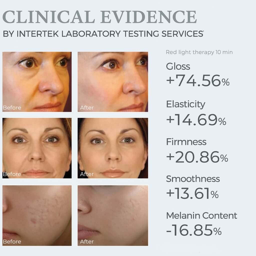 Before and after effects of red light therapy on skin, with Intertek Laboratory Testing Services verification.