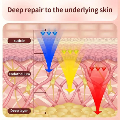 Diagram of skin layers with labels and arrows indicating deep repair process.